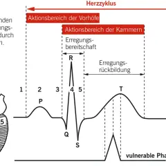 Herzzyklus: Darstellung der Erregungsausbreitung im Herzen und des EKG. Die wirkungen des elektrischen stroms werden durch die Phasen des Herzschlags erklärt.